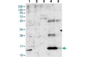 Western blot analysis of Lane 1: RT-4, Lane 2: U-251 MG, Lane 3: Human Plasma, Lane 4: Liver, Lane 5: Tonsil with PLAC8 polyclonal antibody . (PLAC8 抗体)