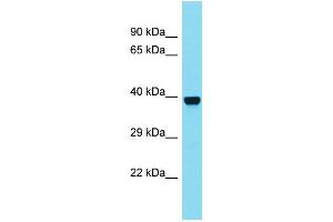 Western Blotting (WB) image for anti-N-Acetylated alpha-Linked Acidic Dipeptidase-Like 2 (NAALADL2) (C-Term) antibody (ABIN2790659) (NAALADL2 抗体  (C-Term))