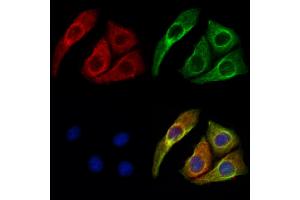 ABIN6261602 and ABIN6273043 staining Hela cells by IF/ICC. (ERO1LB 抗体  (Internal Region))
