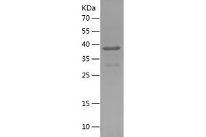 PODXL Protein (AA 23-340) (His tag)