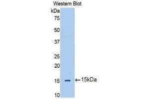Western blot analysis of the recombinant protein. (IL13RA2 抗体  (AA 238-334))