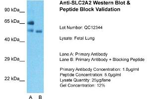 Host: Rabbit  Target Name: SLC2A2  Sample Tissue: Fetal LungLane A:  Primary Antibody Lane B:  Primary Antibody + Blocking Peptide Primary Antibody Concentration: 1 µg/mL Peptide Concentration: 5 µg/mL Lysate Quantity: 41 µg/laneGel Concentration:. (SLC2A2 抗体  (N-Term))