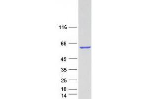 Western Blotting (WB) image for Annexin A11 (ANXA11) (Transcript Variant B) protein (Myc-DYKDDDDK Tag) (ABIN2714731)