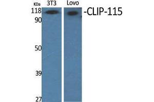 Western Blot (WB) analysis of specific cells using CLIP-115 Polyclonal Antibody. (CLIP2 抗体  (C-Term))