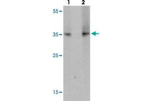 Western blot analysis of TLX1 in mouse spleen tissue with TLX1 polyclonal antibody  at (lane 1) 1 ug/mL and (lane 2) 2 ug/mL. (TLX1 抗体  (N-Term))