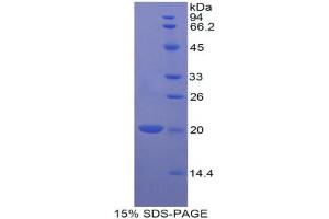 SDS-PAGE analysis of Dog Bcl2L2 Protein. (BCL2L2 蛋白)