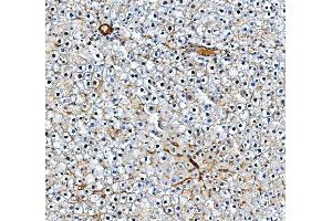 IHC analysis of Pecam1 using anti-Pecam1 antibody (ABIN7601672). (CD31 抗体  (AA 41-491))