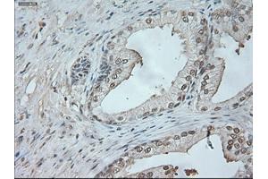 Immunohistochemical staining of paraffin-embedded lung tissue using anti-NEUROG1mouse monoclonal antibody. (Neurogenin 1 抗体)