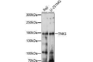 Western blot analysis of extracts of various cell lines, using TNKS antibody (ABIN7270725) at 1:1000 dilution. (TNKS 抗体  (AA 1050-1150))