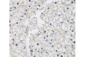 Immunohistochemistry of paraffin-embedded Human liver using CDK7 Polyclonal Antibody at dilution of 1:150 (40x lens). (CDK7 抗体)