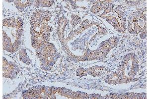 IHC analysis of PDCD6IP using anti-PDCD6IP antibody (ABIN7600490). (ALIX 抗体  (AA 2-330))