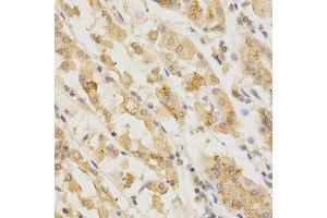 Immunohistochemistry (Paraffin-embedded Sections) (IHC (p)) image for anti-Golgi-Associated, gamma Adaptin Ear Containing, ARF Binding Protein 2 (GGA2) (AA 1-300) antibody (ABIN3021665)