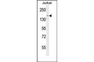 Western blot analysis of PPRC1 Antibody (C-term) in Jurkat cell line lysates (35ug/lane). (PPRC1 抗体  (C-Term))