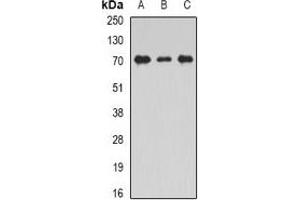 Western blot analysis of Unc18-2 expression in THP1 (A), Jurkat (B), mouse testis (C) whole cell lysates. (STXBP2 抗体)