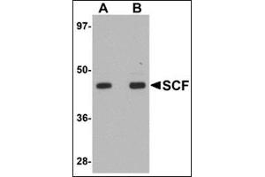 Western blot analysis of SCF in rat brain tissue lysate with this product at (A) 1 and (B) 2 μg/ml. (KIT Ligand 抗体  (Center))