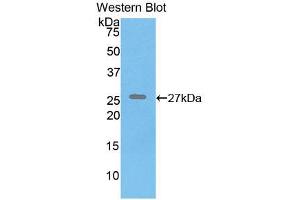 Western blot analysis of recombinant Human ELN. (Elastin 抗体  (AA 392-645))