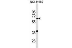 Western Blotting (WB) image for anti-PET112 Homolog (PET112) antibody (ABIN2999660) (PET112L 抗体)