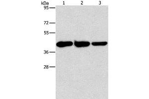 Western Blot analysis of Human normal liver tissue, Mouse brain and heart tissue using GOT1 Polyclonal Antibody at dilution of 1:1600 (GOT1 抗体)