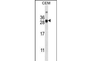 CIDEA Antibody (C-term) (ABIN657978 and ABIN2846924) western blot analysis in CEM cell line lysates (35 μg/lane). (CIDEA 抗体  (C-Term))