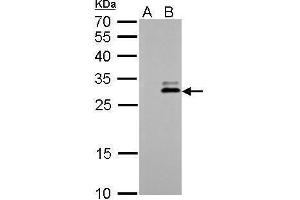 WB Image KLK7 antibody detects KLK7 protein by Western blot analysis. (Kallikrein 7 抗体)