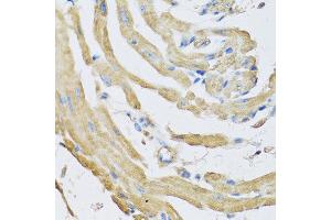 Immunohistochemistry of paraffin-embedded mouse heart using SFRP4 antibody at dilution of 1:100 (40x lens). (SFRP4 抗体)