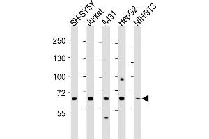 All lanes : Anti-MeCP2 Antibody at 1:2000 dilution Lane 1: SH-SY5Y whole cell lysates Lane 2: Jurkat whole cell lysates Lane 3: A431 whole cell lysates Lane 4: HepG2 whole cell lysates Lane 5: NIH/3T3 whole cell lysates Lysates/proteins at 20 μg per lane. (MECP2 抗体  (AA 400-428))