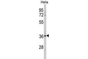 Western blot analysis of MDFIC Antibody (N-term) in Hela cell line lysates (35ug/lane).