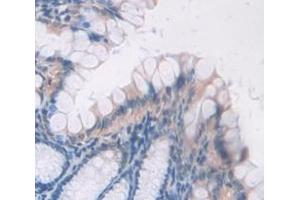 IHC-P analysis of Mouse Tissue, with DAB staining. (BMP2 抗体  (AA 281-394))