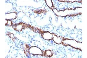 IHC testing of FFPE rat kidney tissue with recombinant Cadherin 16 antibody (clone CDH16/1532R). (Recombinant Cadherin-16 抗体)