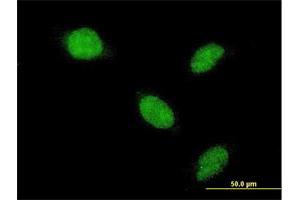 Immunofluorescence of monoclonal antibody to AHR on HeLa cell. (Aryl Hydrocarbon Receptor 抗体  (AA 721-820))