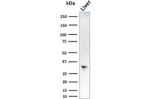 Western Blot Analysis of liver tissue lysate using SULT1E1 Mouse Monoclonal Antibody (CPTC-SULT1E1-1). (SULT1E1 抗体)