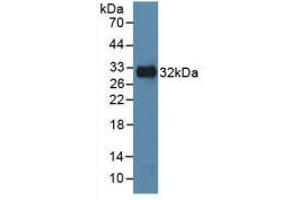 Western blot analysis of recombinant Human MAPK8. (JNK 抗体  (AA 145-419))