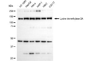 Western blotting analysis using lysine demethylase 2A antibody (ABIN7799299). (Recombinant KDM2A 抗体)