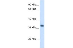 Western Blotting (WB) image for anti-3-Hydroxymethyl-3-Methylglutaryl-CoA Lyase (HMGCL) antibody (ABIN2462454) (HMGCL 抗体)