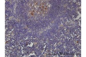 Immunoperoxidase of monoclonal antibody to KIAA0101 on formalin-fixed paraffin-embedded human lymph node tissue. (KIAA0101 抗体  (AA 1-111))