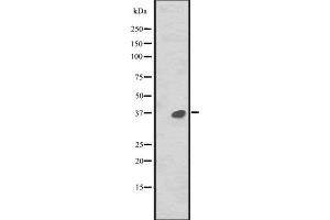 Western blot analysis of MAPRE2 expression in CEM cell line lysate ,The lane on the left is treated with the antigen-specific peptide. (MAPRE2 抗体  (Internal Region))