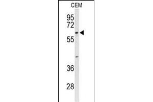 Western blot analysis of TCHP Antibody (Center) (ABIN653303 and ABIN2842803) in CEM cell line lysates (35 μg/lane). (TCHP 抗体  (AA 291-320))