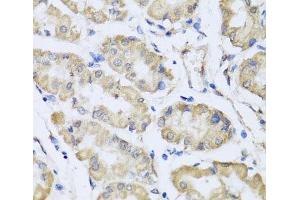 Immunohistochemistry of paraffin-embedded Human stomach using RCN2 Polyclonal Antibody at dilution of 1:100 (40x lens). (RCN2 抗体)