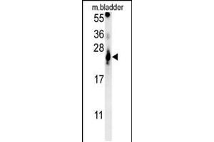 Western blot analysis in mouse bladder tissue lysates (15ug/lane).