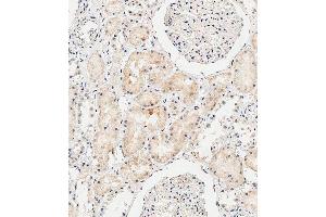 Immunohistochemistry (Paraffin-embedded Sections) (IHC (p)) image for anti-Collagen, Type VIII, alpha 2 (COL8A2) (AA 571-599), (C-Term) antibody (ABIN655804)