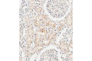 Immunohistochemical analysis of paraffin-embedded Human kidney tissue using B performed on the Leica® BOND RXm. (COL8a2 抗体  (C-Term))