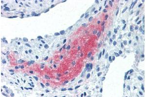 Human Uterus, Myometrium (formalin-fixed, paraffin-embedded) stained with LEFTY2 antibody ABIN337262 at 10 ug/ml followed by biotinylated anti-mouse IgG secondary antibody ABIN481714, alkaline phosphatase-streptavidin and chromogen. (LEFTY2 抗体)