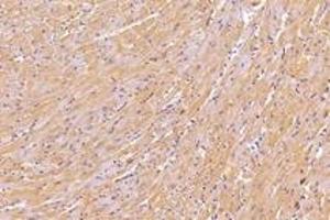 Immunohistochemistry analysis of paraffin-embedded mouse heart using,KIF5B (ABIN7074440) at dilution of 1: 1000 (KIF5B 抗体)