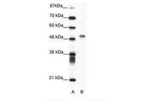 Image no. 1 for anti-Friend Leukemia Virus Integration 1 (FLI1) (N-Term) antibody (ABIN202560) (FLI1 抗体  (N-Term))
