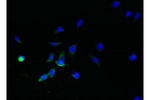 Immunofluorescent analysis of HepG2 cells using ABIN7170902 at dilution of 1:100 and Alexa Fluor 488-congugated AffiniPure Goat Anti-Rabbit IgG(H+L) (SDHC 抗体  (AA 30-62))