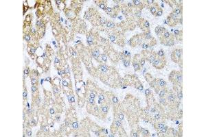 Immunohistochemistry (Paraffin-embedded Sections) (IHC (p)) image for anti-Cytochrome C Oxidase Subunit Vb (COX5B) antibody (ABIN7260609)