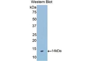 Western blot analysis of the recombinant protein. (GNRH1 抗体  (AA 25-92))