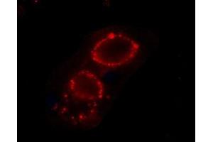 Expression of CaVα2δ3 in rat PC12 cellsCell surface detection of CaVα2δ3 in intact living PC12 cells.
