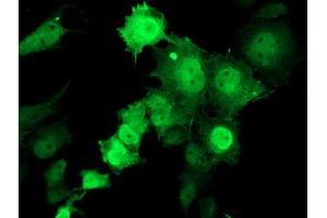 Anti-TMOD1 mouse monoclonal antibody (ABIN2454758) immunofluorescent staining of COS7 cells transiently transfected by pCMV6-ENTRY TMOD1 (RC201134). (Tropomodulin 1 抗体)