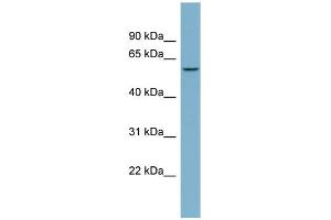 WB Suggested Anti-PPP5C Antibody Titration: 0. (PP5 抗体  (N-Term))